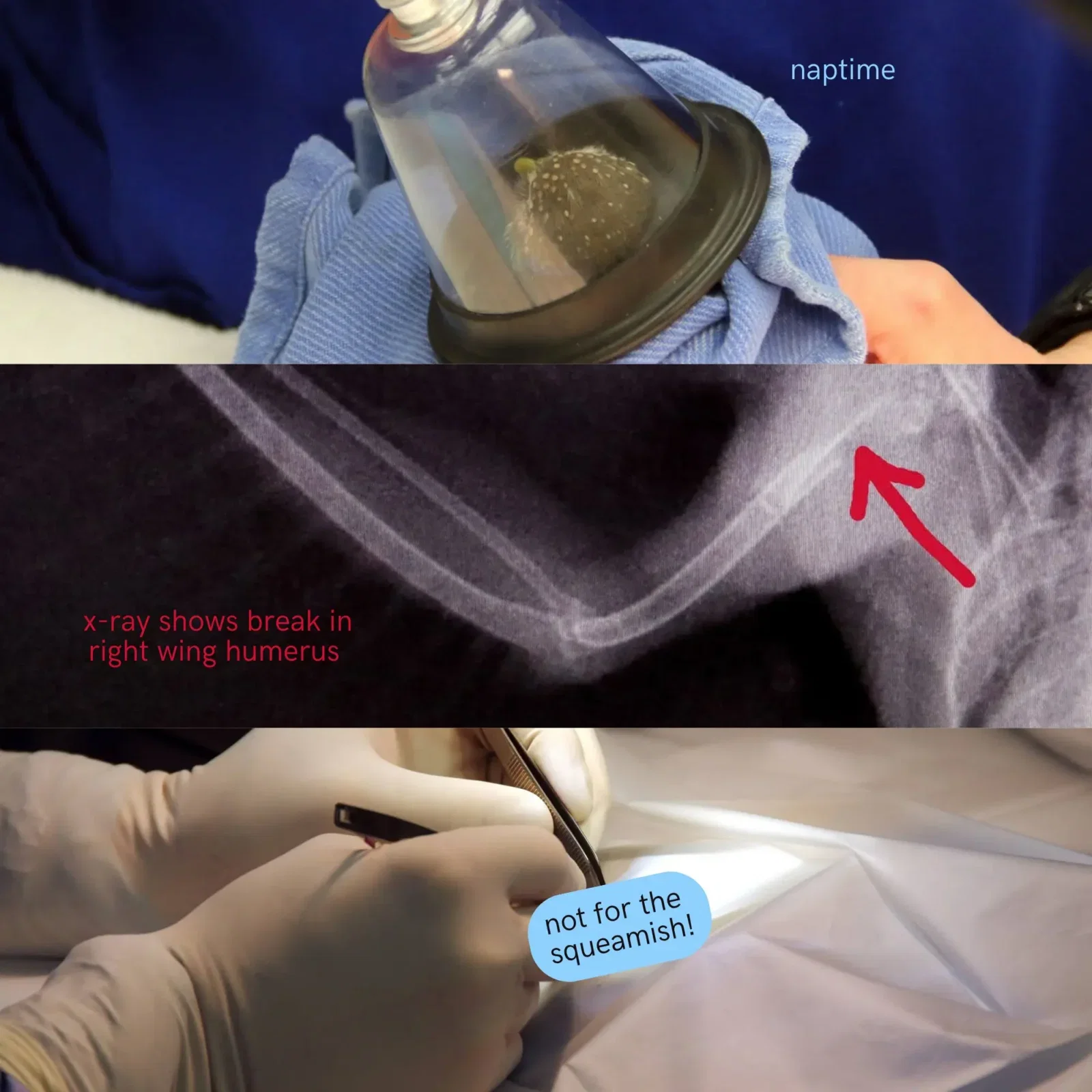 This image has 3 horizontal panels: Panel one shows the patient (same owl + same towel) receiving anaesthesia gas via a transparent cone-shaped mask with a tube out the top. Text to the right reads "naptime". Panel two is an x-ray of the owl's wing with an arrow pointing to the biggest bone. Text in red says "break in right wing humerus" but I don't think it's very funny. Panel three shows the operation. The vet surgeon wears white medical gloves and wields metallic tools aimed at a hole in a plastic sheet covering the patient. A text block reads "not for the squeamish!" and occludes the grisly details.
